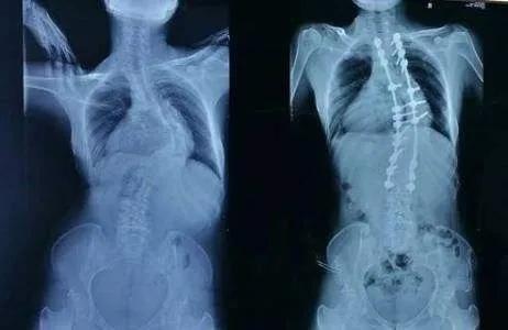 nba球星的鞋垫有什么特别之处,nba球星为什么要把鞋垫取出来