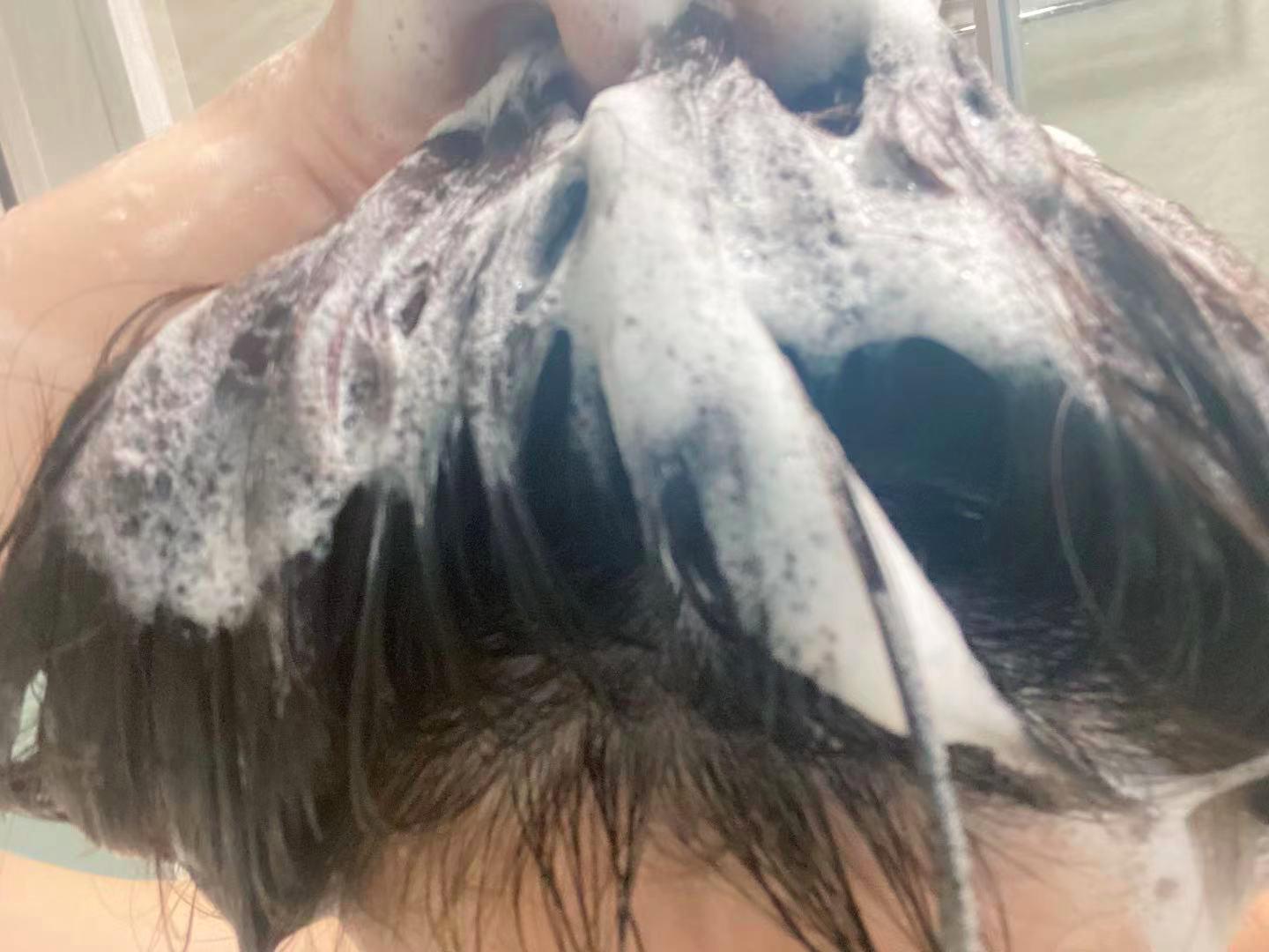 小宝宝脱发严重怎么办,拯救脱发小宝贝