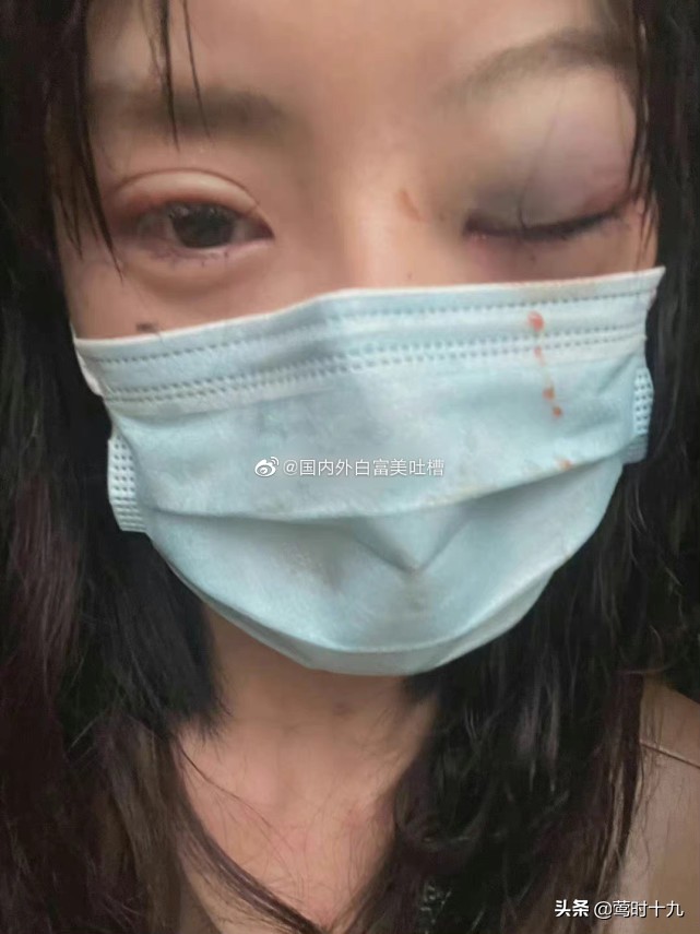 网红被家暴曝光,盘点网红遭家暴