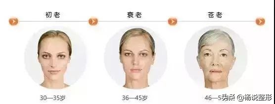 28岁做线雕提升脸部好不好,28岁女人做线雕现状