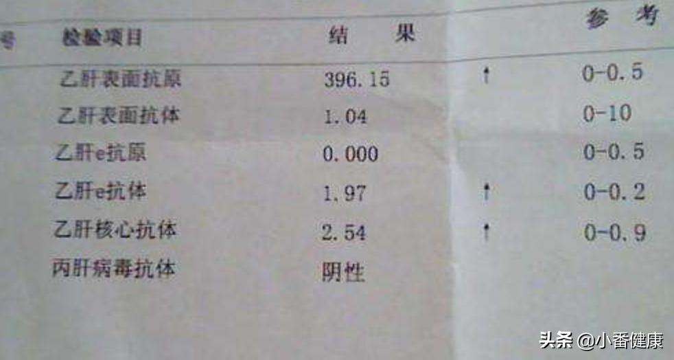 乙肝携带最新用药指南,乙肝病毒携带者的诊断及治疗