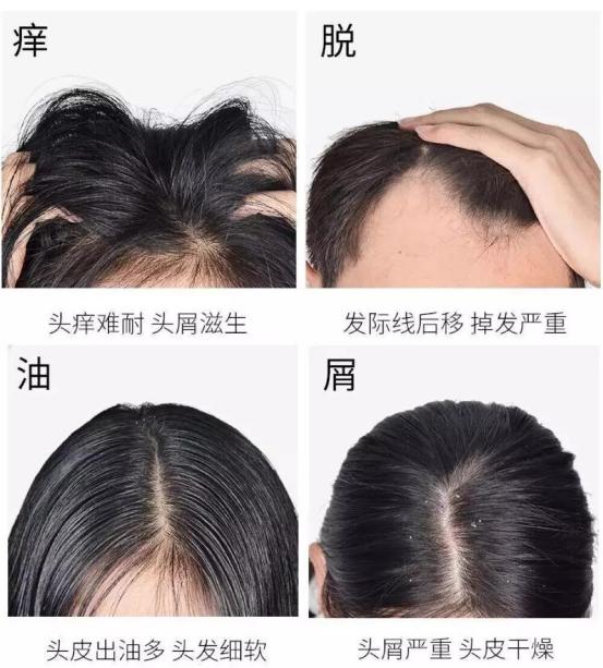 能让头发乌黑靓丽的洗发用品,用什么洗发水能让头发浓密乌黑