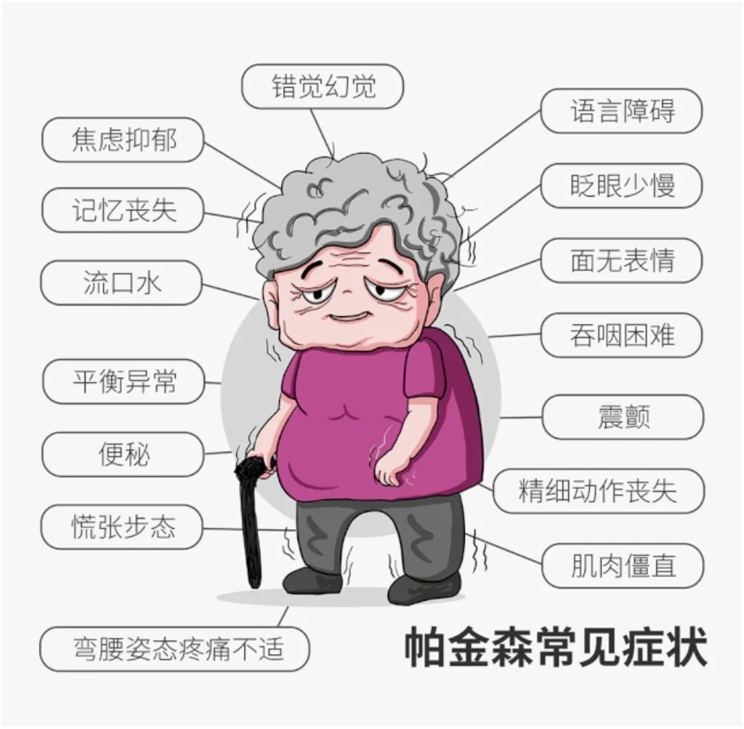 帕金森综合症中医经方治疗医案,早期的帕金森治愈成功案例