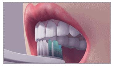 接吻时有生理反应？更尴尬的是牙黄还有口臭好吗…