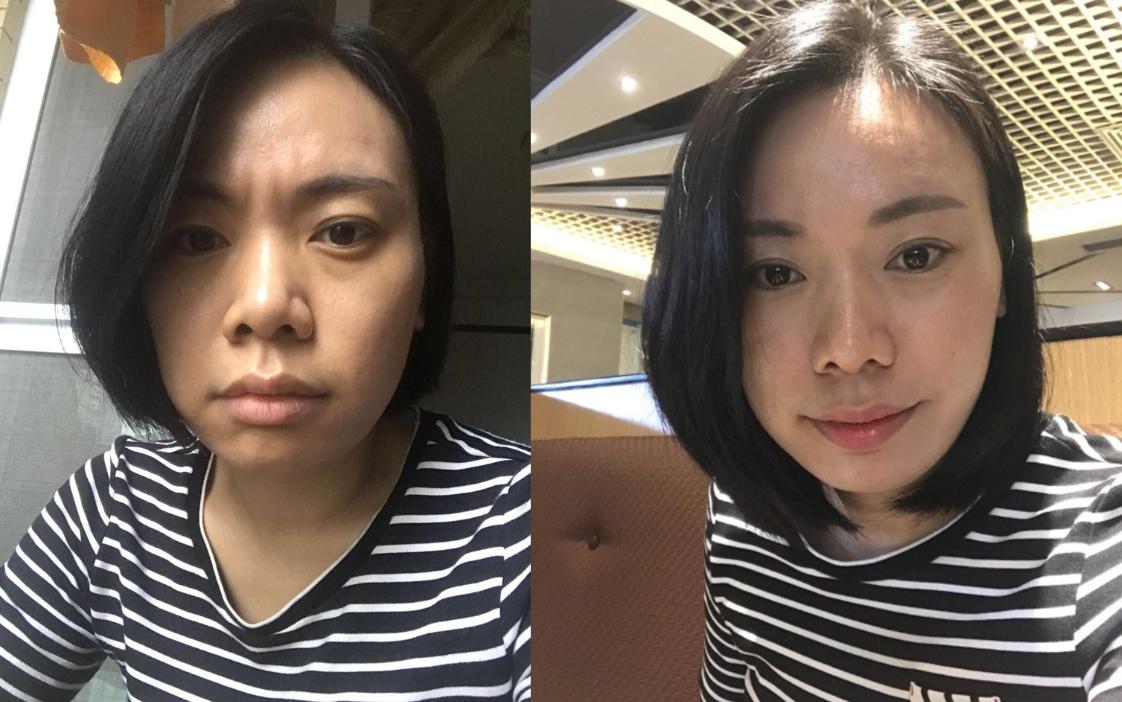 抗衰不再是简单的面部抗衰,风靡全球面部抗衰的最好方法