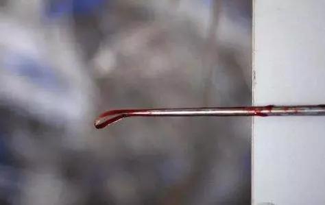 做了无痛人流手术后要注意什么,做了人流手术后应该注意保暖吗