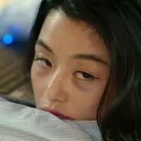 黑眼圈起皮干痒是什么原因,熬夜黑眼圈皮肤的救星