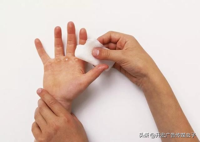 小孩烫伤起水泡要不要挑破,烫伤水泡反复鼓起要反复刺破吗