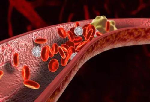 治疗血脂高中药有哪几种,血脂高中药怎么调理