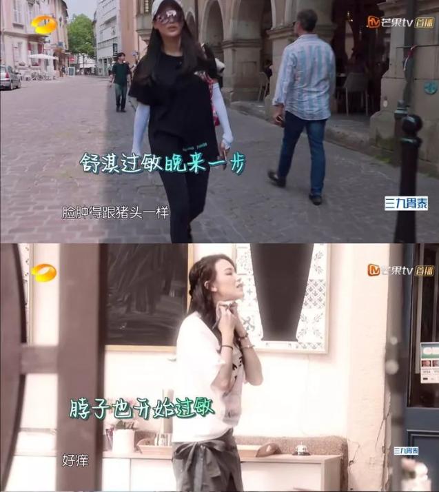 舒淇皮肤过敏,舒淇皮肤过敏化妆