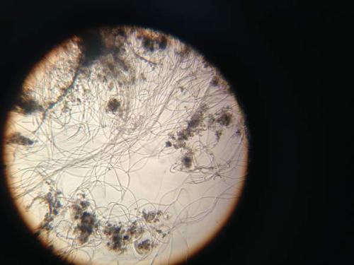 环保池污泥最佳处理方法,水处理污泥怎么处理