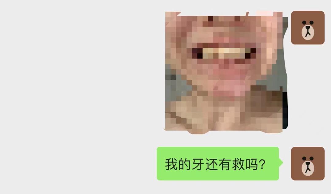 9.9隐形牙套,自制防磨牙套