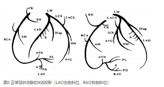 清晰完整揭秘冠脉造影全部过程,冠脉造影教学视频