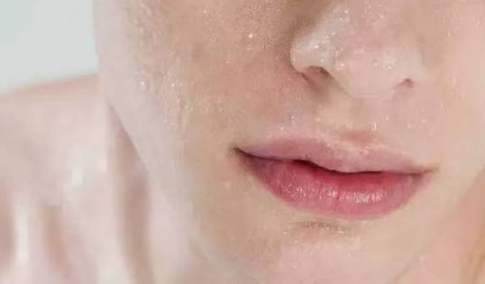 适合皮肤干燥缺水时使用的8种精油