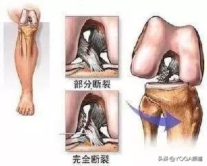 如何正确拉伸韧带，新手应该避免的问题