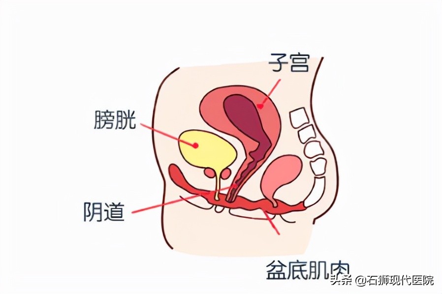 不做盆底肌修复的危害,石狮产后盆底肌修复