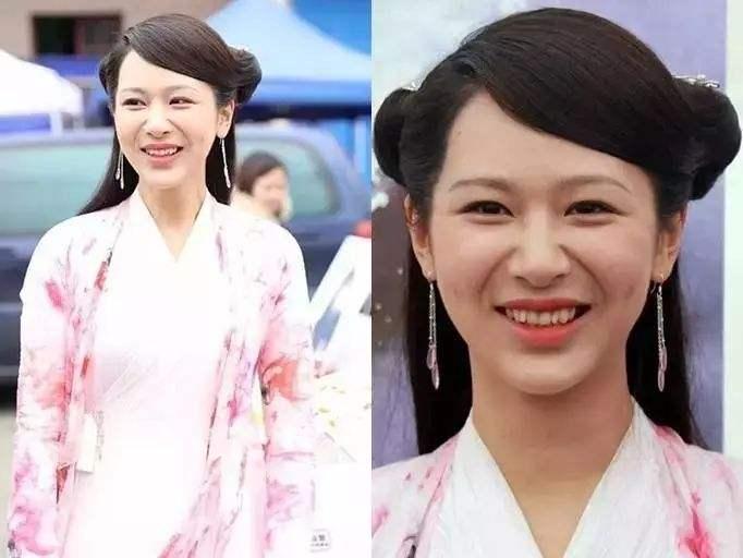 法令纹加深是什么情况？郑爽、杨紫都避免不了，如何去解决？