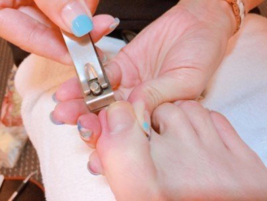 一到夏季脚气犯了怎么办,香港脚教你一招解决脚气