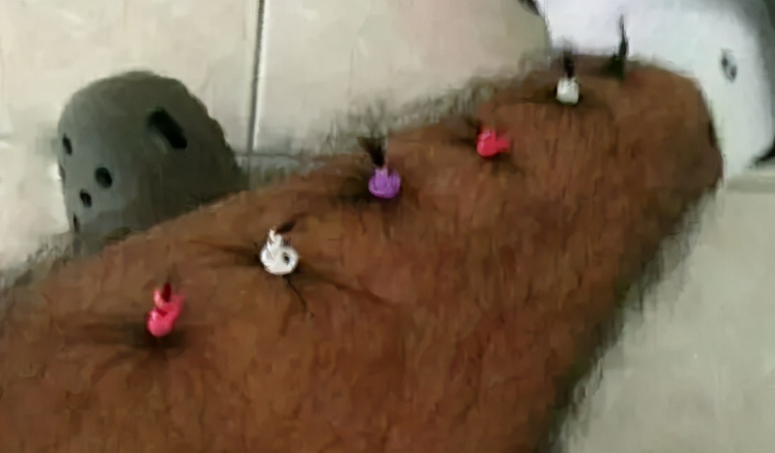 民间脱毛土方法秘方大全,脱毛民间办法