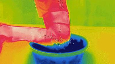 全国有多少关节炎患者,中国关节炎患者超过1亿人