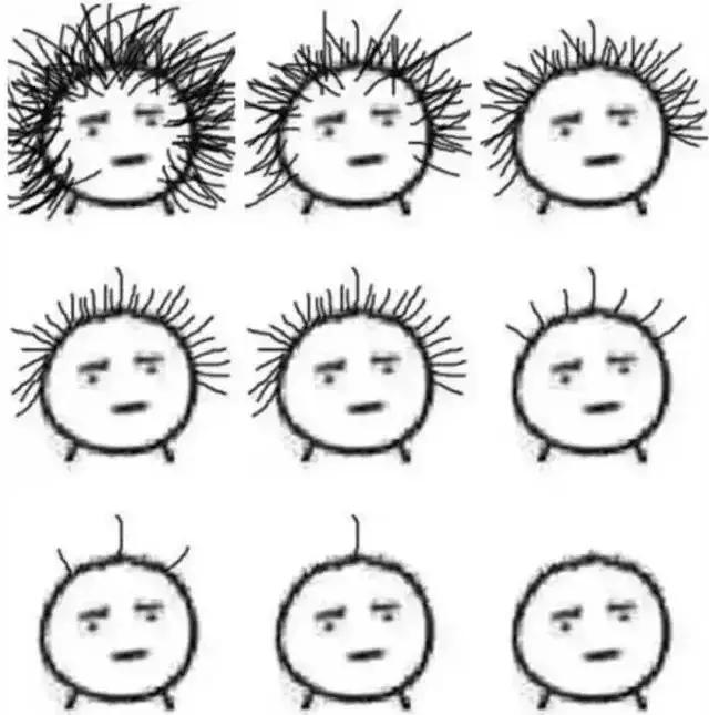 一个秃头的自救经验：最有效的“生发剂”只有这几种