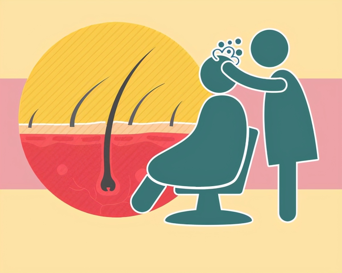 脂溢性皮炎脱发可以一天一洗头吗,脂溢性皮炎导致脱发怎么改善