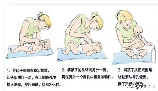 治宝宝鼻塞的方法,宝宝鼻塞流涕的家庭护理方法