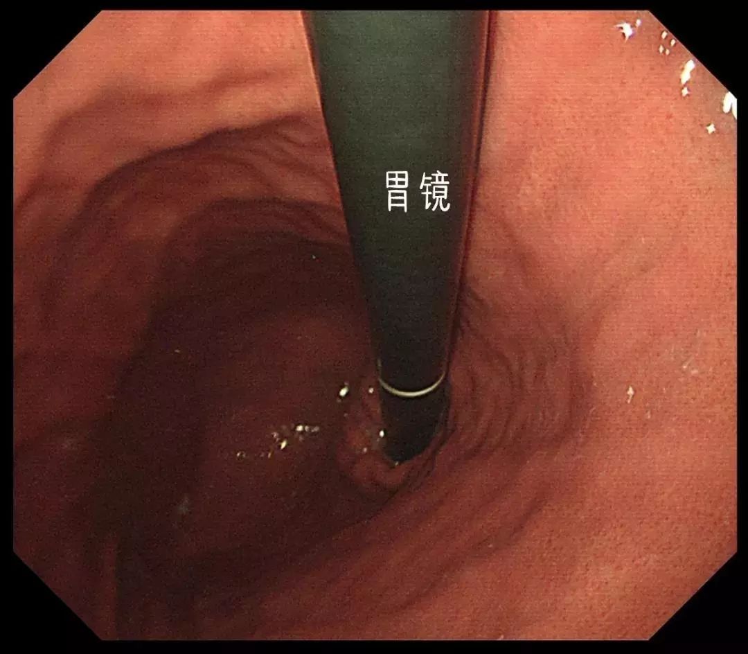 医生说的检查项目我们都必须做吗,医生告诉你应该做哪些检查