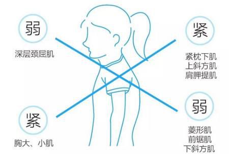 什么是“富贵包”?学会这几招,完美摆平颈后大包!