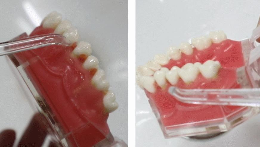 四款冲牙器对比,请问能推荐两款冲牙神器吗