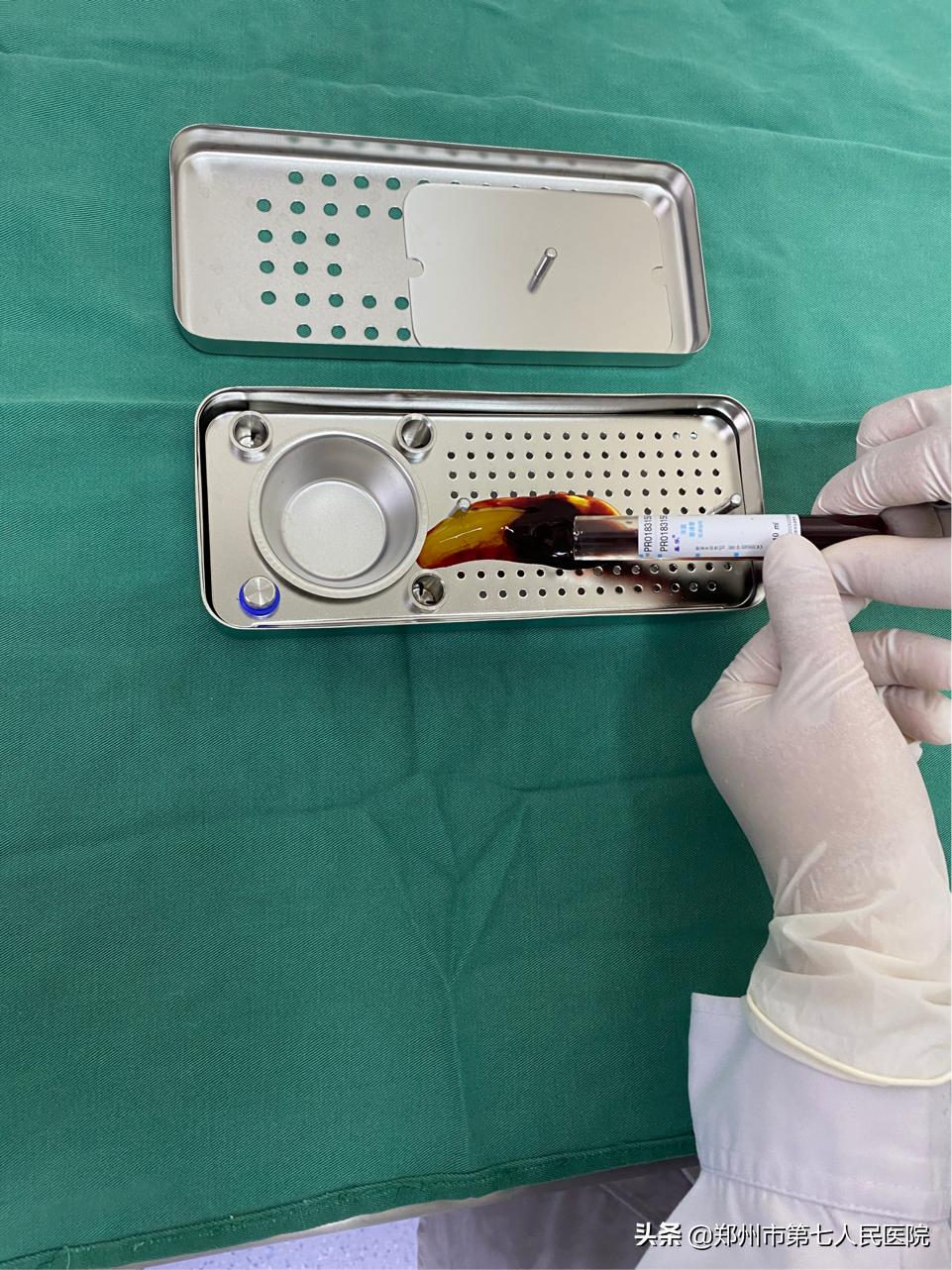 看牙也抽血?什么是CGF?