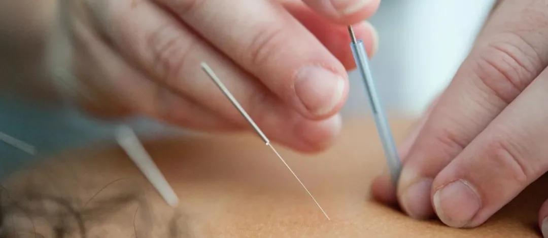 从单打独斗到抱团发展,单打独斗与团队合作