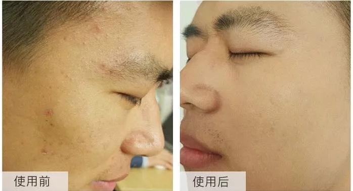 毛戈平遮瑕手法李佳琦 (李佳琦毛戈平推荐)