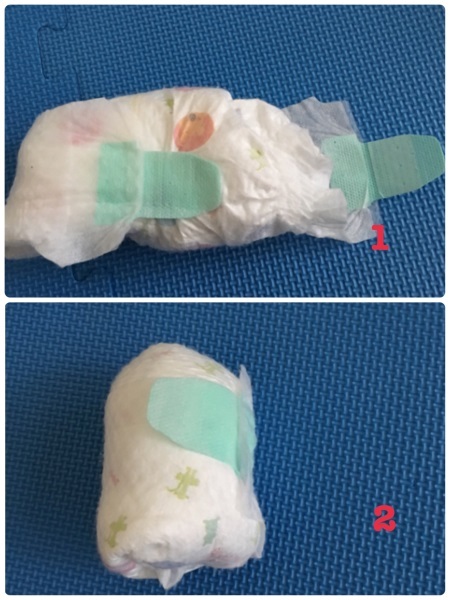 宝宝拉屎漏尿正确方法,宝宝红屁屁漏尿怎么回事