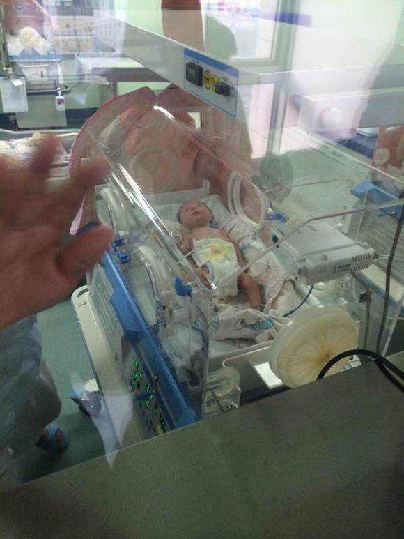 大宝31周+2早产，我是如何死里逃生把她养育成一个大姑娘？