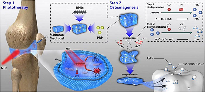 基于黑磷纳米片的多功能温敏水凝胶系统治疗类风湿