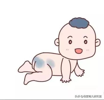 宝宝身上的青胎记能消么,宝宝身上有很多胎记淤青是为什么