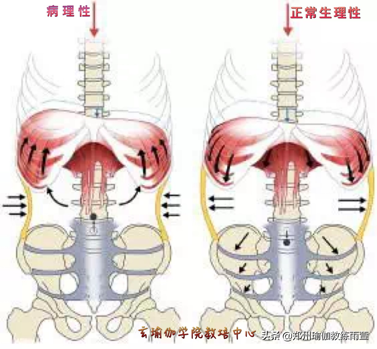 有肋骨外翻，锁骨窝凹陷，腰部疼痛的症状吗？你需要重新认识呼吸