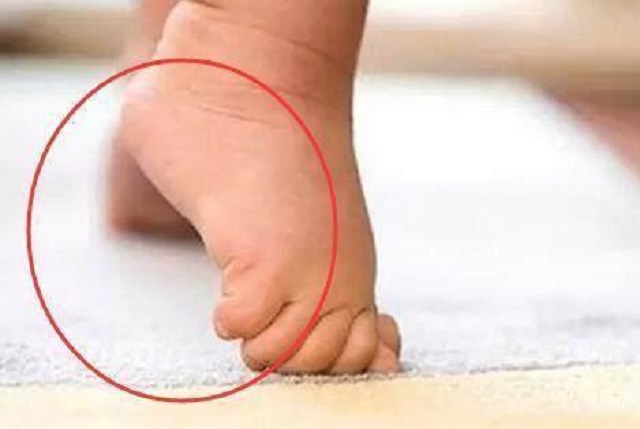 宝宝走得早会影响腿型发育吗,婴儿几个月练站不影响腿部发育