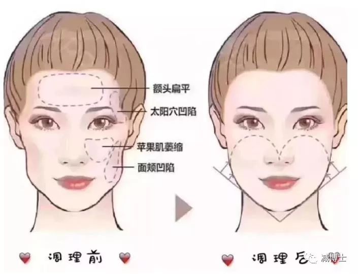 脸好大如何瘦脸,脸好大怎么恢复