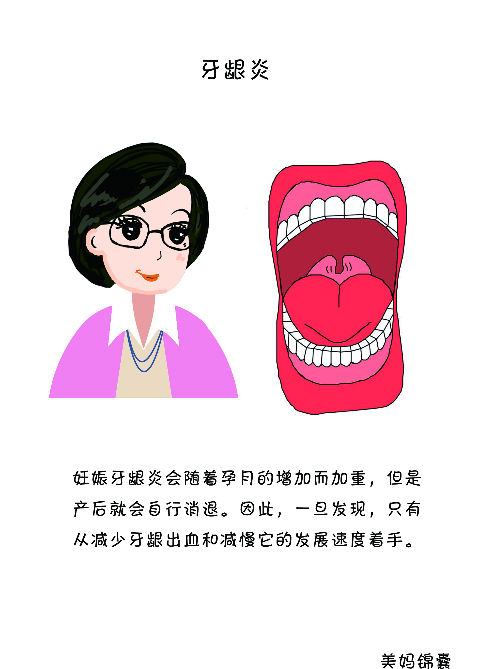 孕期牙龈炎严重怎么办,孕期牙龈炎老出血