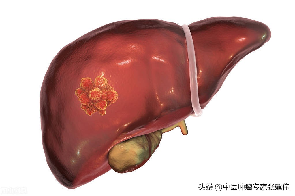 胃痛肝癌,肝癌导致的胃疼怎么解决