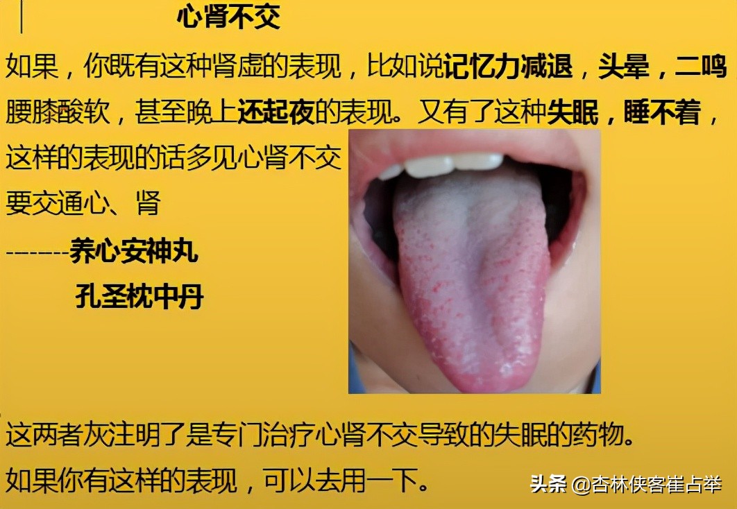 治疗失眠什么中成药效果好,治疗失眠中成药大总结