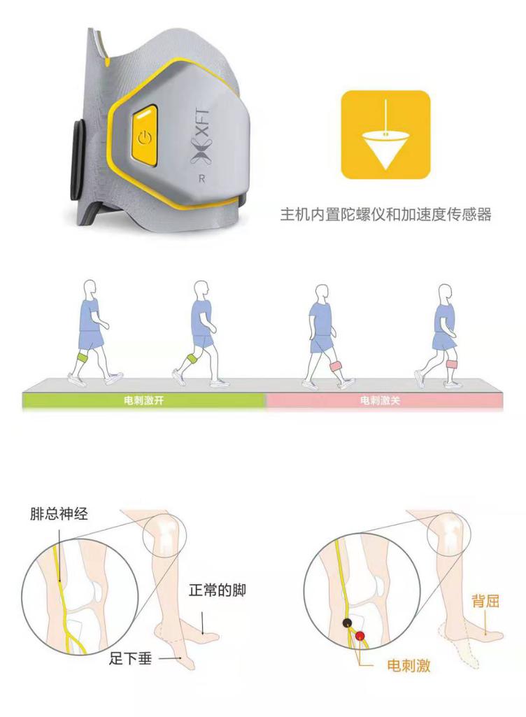 脑卒中科普知识及康复知识普及,早看早受益的方法