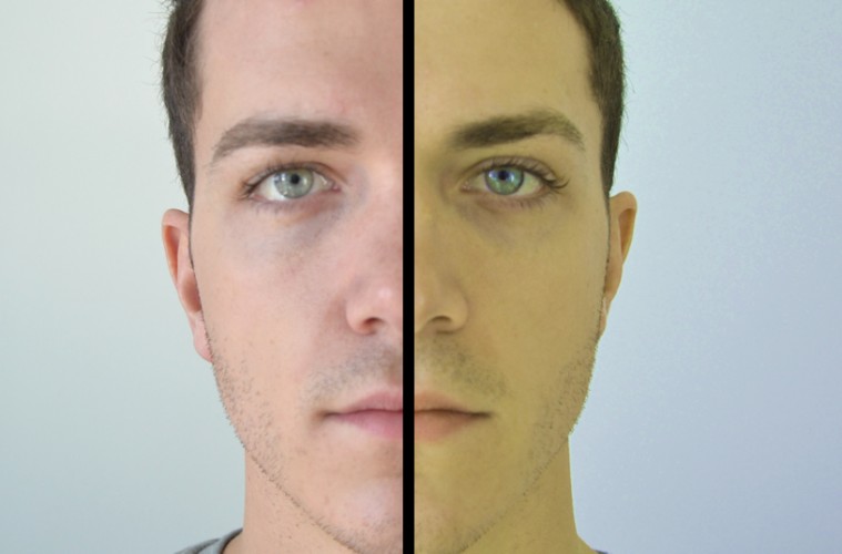 不论男女，身体这5处变黄，十有八九，是你的肝脏在“求救”