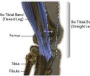 如何跑步才能避免髂胫束综合征,膝盖外侧髂胫束疼痛跑步怎么保护