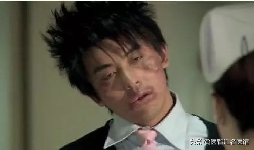 布洛芬真的有那么可怕吗,布洛芬可怕后果