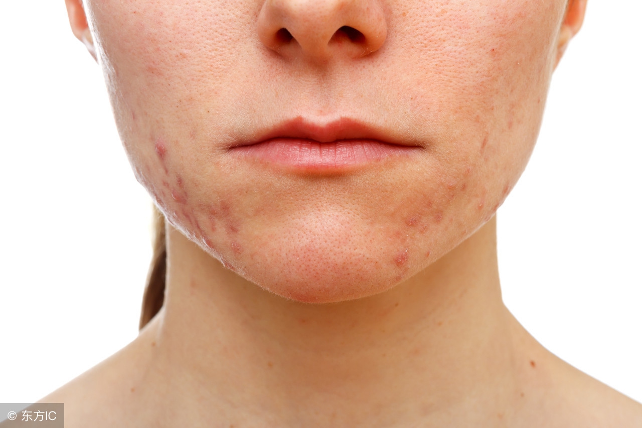 姨妈期皮肤好怎么维持,来姨妈皮肤差怎么缓解