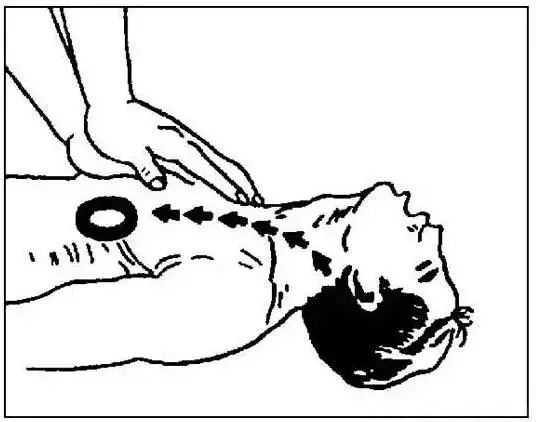 10千伏触电急救方法,电力人员正确触电抢救法