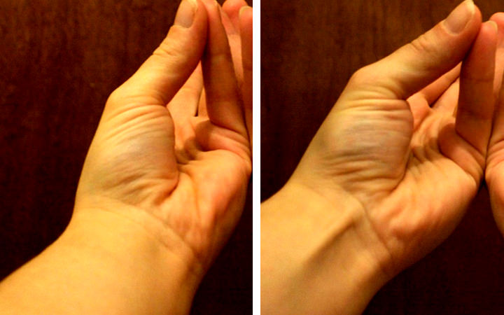 人体胳膊变异,人体十大变异